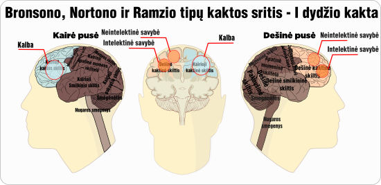 Bronsono-Nortono Ramzio kakta