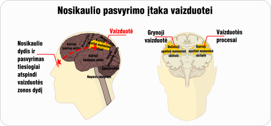 nosikaulio pasvyrimas vaizduote